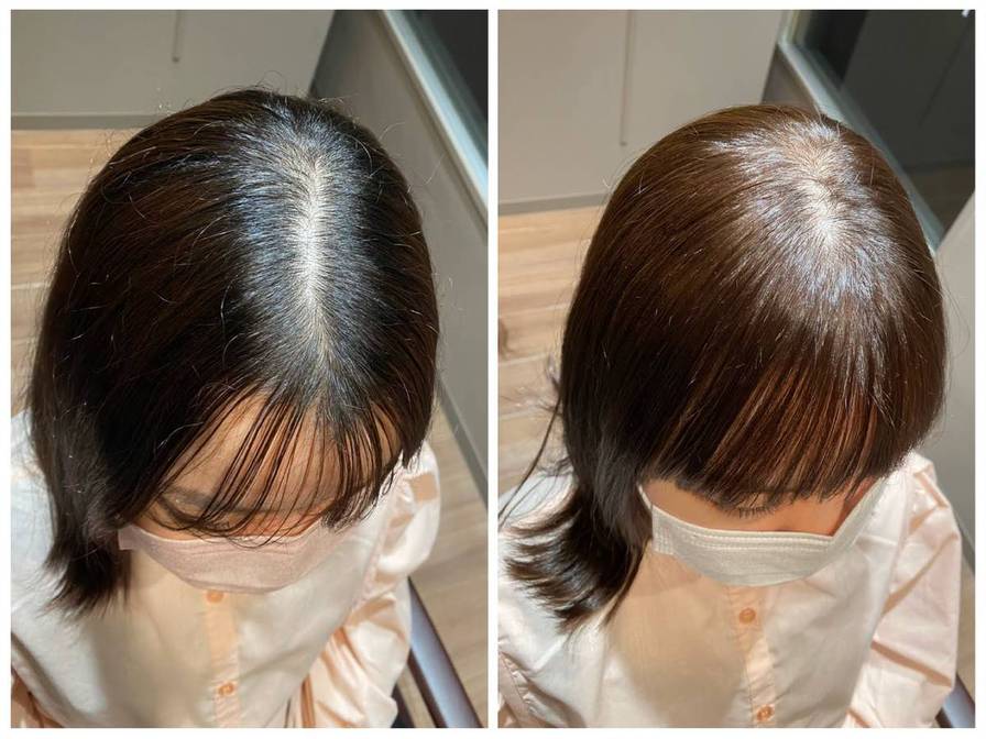 Column 薄毛に悩む女性の為のヘアサロン 美容院 Telas テラス 東京 渋谷