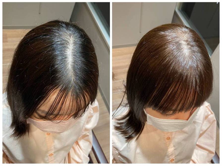 女性薄毛 前髪 薄毛対策 前髪カット 部分コスメストレート 薄毛に悩む女性の為のヘアサロン 美容院 Telas テラス 東京 渋谷 女性薄毛 前髪 薄毛対策 前髪カット 部分コスメストレート 薄毛に悩む女性の為のヘアサロン 美容院 Telas テラス 東京 渋谷
