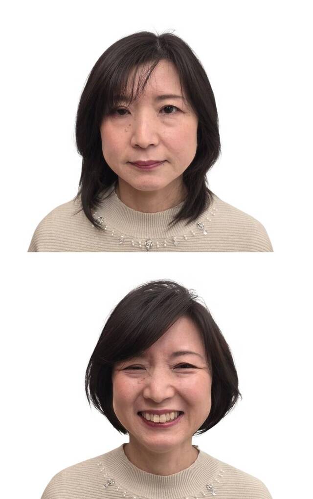 【女性薄毛　すだれ毛】分け目が気になってきたら貴方へ、盛りふんわりヘア！